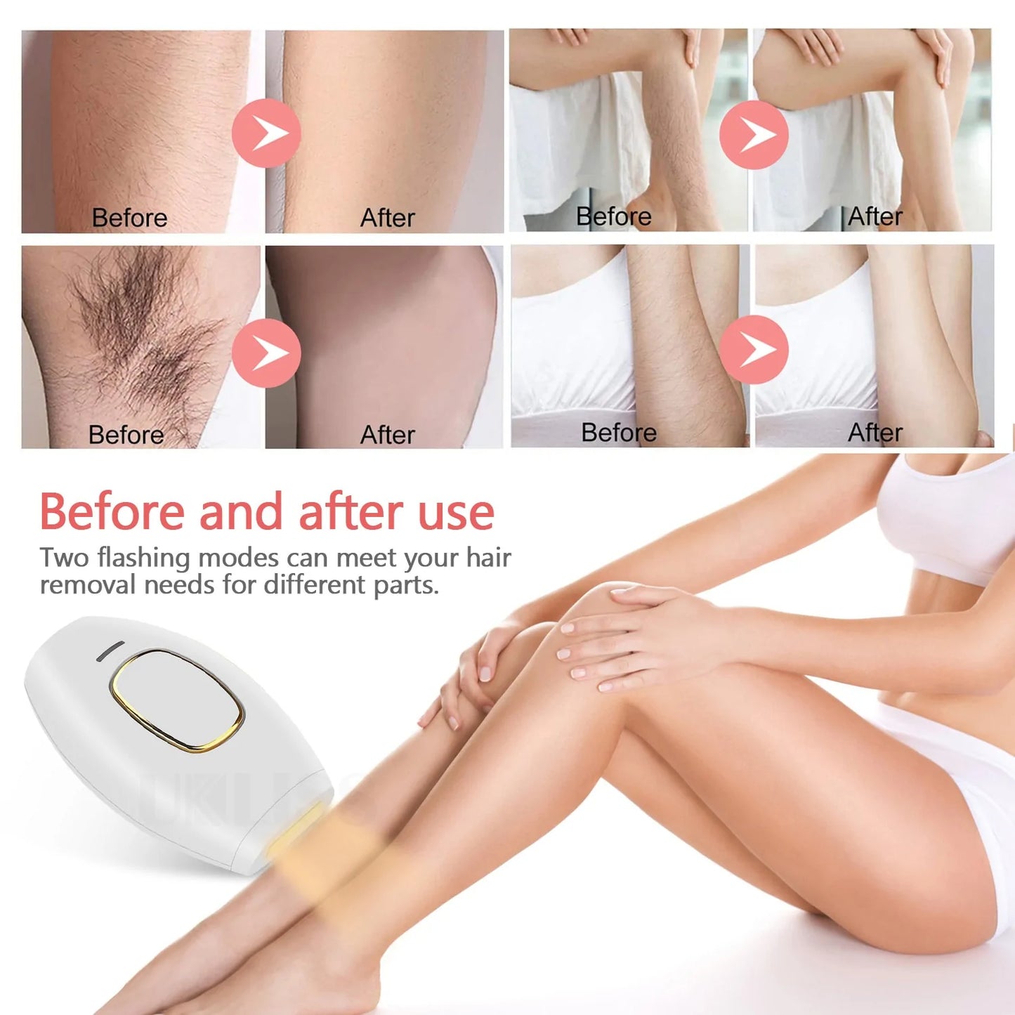 Electric Laser Epilator For Women